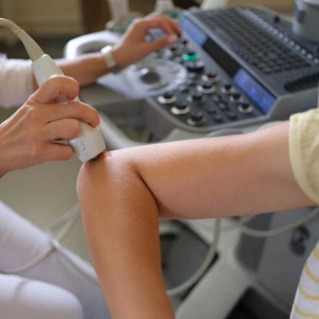 Kolor dopler pregled krvnih sudova - ultrazvuk ruke