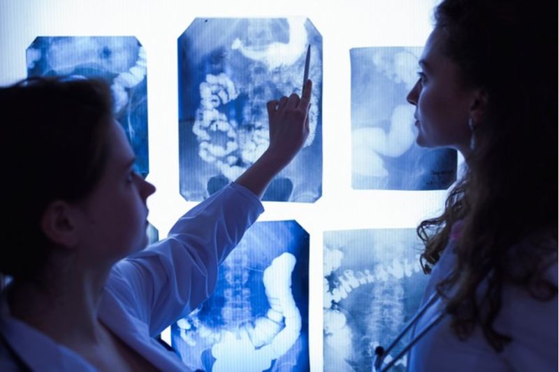 RTG pluća - radiološki pregled