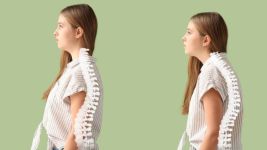 Skolioza: Uzroci, simptomi i tretman