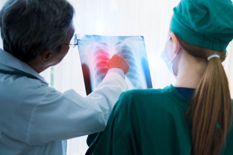 Apsces pluća