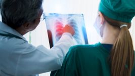 Uzroci, simptomi i tretmani apscesa pluća