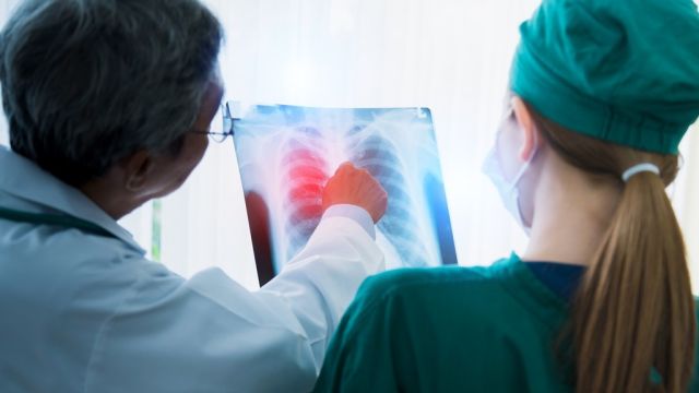 Uzroci, simptomi i tretmani apscesa pluća Uzroci, simptomi i tretmani apscesa pluća