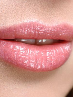 Hijaluronski fileri - estetski tretman