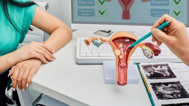 Teratom jajnika: Uzroci i simptomi Teratom jajnika: Uzroci i simptomi