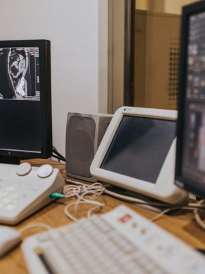 MSCT snimanje abdomena