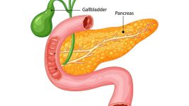 Holecistitis: Kako prepoznati i lečiti upalu žučne kese
