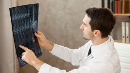 Kako se dijagnostikuje i leči fraktura rebara?