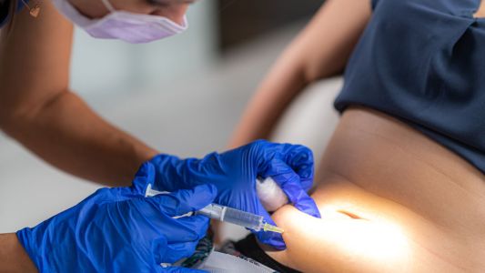 Tretman lipolizom Tretman lipolizom