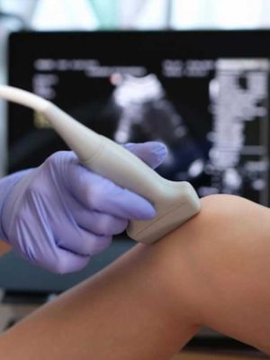 Kolor dopler ruku ili nogu - pregled krvnih sudova