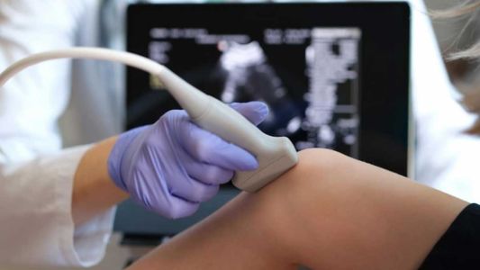 Kolor dopler ruke ili noge