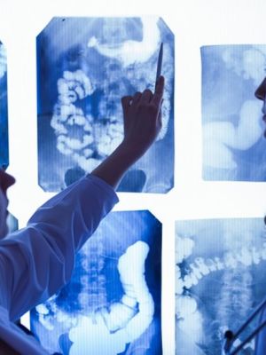 RTG pluća - radiološki pregled